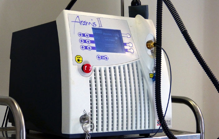 Laser pour le traitement de l'acn&eacute; &agrave; Toulouse